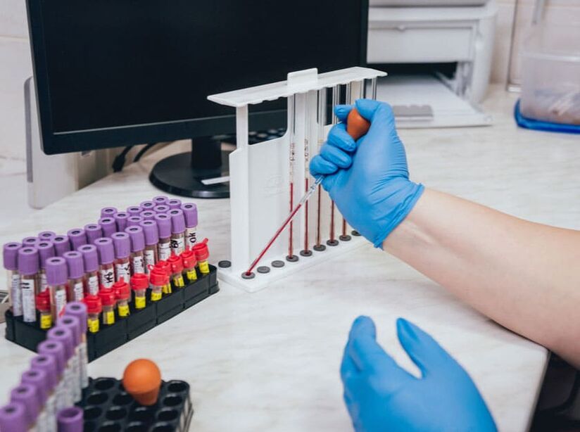 measuring blood sugar after drinking alcohol